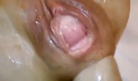 El pelo No a maduras calvo!