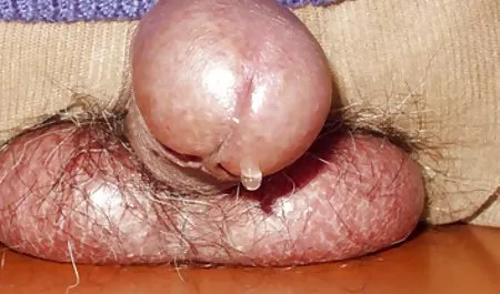 Masaje chica maduras sin bragas pubis en la esquina de la cama.